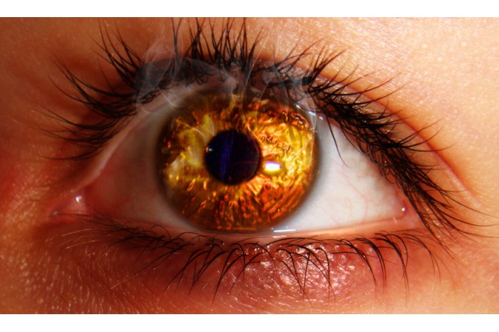Болят глаза после сварки – что делать?